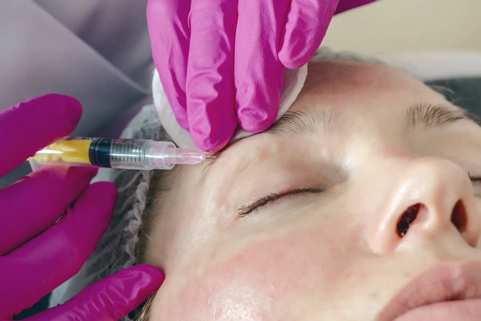 Injection esthétique réalisée par un praticien ganté